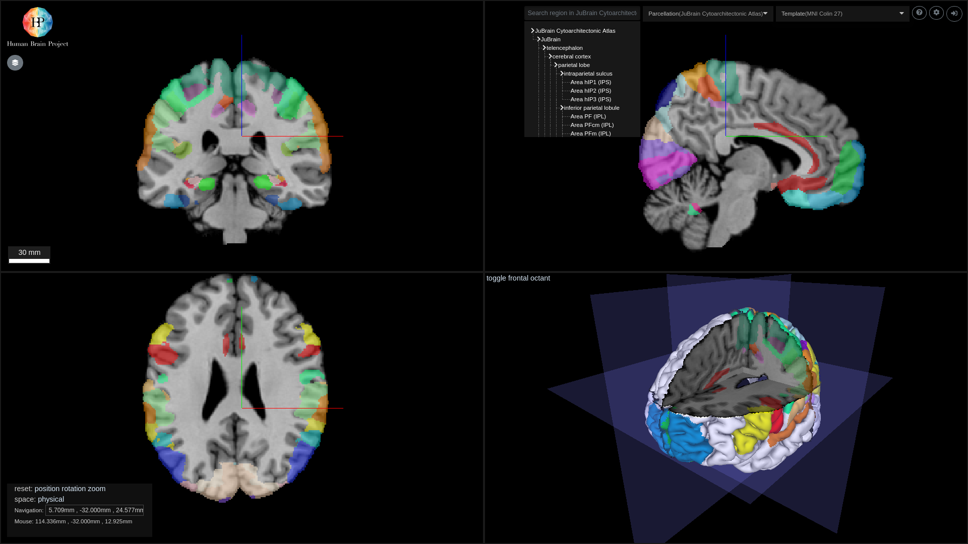 Preview of Julich Brain Cytoarchitectonic map in MNI Colin 27 space